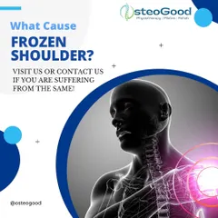 A frozen shoulder is characterized by stiffness and pain in the joint. It's often caused by immobility after an injury or surgery, which is why starting gentle range-of-motion exercises early is so important.