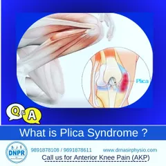 This Q&A graphic explains Plica Syndrome, a condition that causes knee pain due to inflammation of tissue in the knee joint. We provide effective conservative treatment for this by focusing on pain management, mobility, and strengthening.