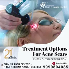 This graphic shows the various advanced treatment options available at my clinic for acne scars. Depending on the type of scar, I may recommend laser resurfacing, chemical peels, microneedling, or fillers to achieve the best results.