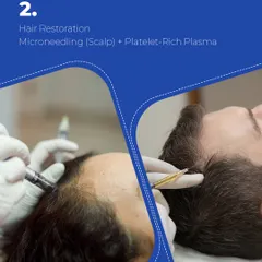 This is a glimpse into our Platelet-Rich Plasma (PRP) treatment. We combine microneedling with the application of PRP to the scalp. This process creates micro-channels that help the growth factors penetrate deeper, stimulating dormant hair follicles and improving blood circulation for better hair density and health.