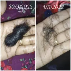 A powerful before-and-after photo from a customer showing the reduction in hair fall after using my hair oil for just over a month. The difference is clear and truly amazing.