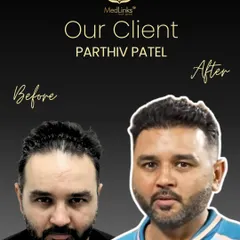 Another champion's comeback. Cricketer Parthiv Patel's before and after transformation showcases the natural and dense result we aim for with every patient.