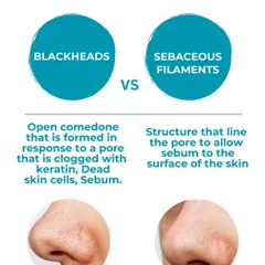 Do you know the difference between blackheads and sebaceous filaments? This graphic breaks it down so you can better understand and treat your skin.