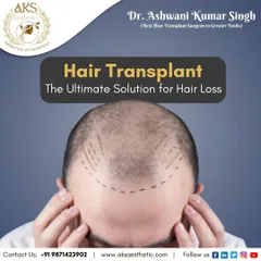 The first step in a hair transplant is careful planning. I mark the recipient area to create a natural and dense hairline, ensuring the final result is tailored specifically to you.