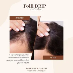 The results speak for themselves. This before and after showcases the transformative effect of our Folli IV Drip infusion. By delivering essential nutrients directly into the bloodstream, we supercharge hair follicles from within to promote renewed, thicker locks.