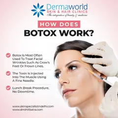 This visual explains how Botox works in a simple way. It is a quick, minimally invasive procedure where a toxin is injected into the muscle to relax it, effectively treating facial wrinkles. It is a true "lunch break" procedure with no downtime.