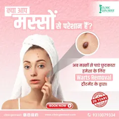 Facial warts, in particular, can be a source of anxiety. My laser treatment offers a permanent and safe solution to remove them effectively, helping you regain your confidence with flawless skin.