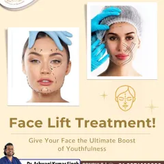 A facelift, or rhytidectomy, is designed to create a naturally refreshed and youthful appearance. This graphic illustrates the areas I address to tighten sagging skin, smooth deep creases, and restore the contours of the face and neck.