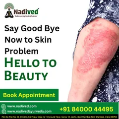Say goodbye to persistent skin problems. My clinic offers holistic Ayurvedic treatments that address the root cause of skin ailments, not just the symptoms. It's time to say hello to beautiful, healthy skin with a personalized healing plan.