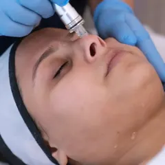 Here you can see the HydraPro tool in action. This is a key part of my deep hydration facial, using advanced technology to gently exfoliate and infuse the skin with moisture for that instant, dewy glow.