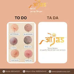 From whiteheads and blackheads to more severe cysts and nodules, we have a solution for every type of acne. Our quality skin and hair care services are designed to tackle your concerns and deliver results.