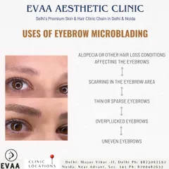 This graphic outlines the primary applications for eyebrow microblading. We recommend this treatment for clients with conditions like alopecia, scarring, thin or sparse eyebrows, overplucked brows, and unevenness.