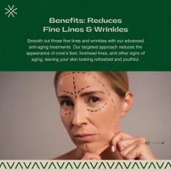 My targeted approach helps to smooth out fine lines and wrinkles. I focus on reducing the appearance of crow's feet and forehead lines for a refreshed and youthful look.