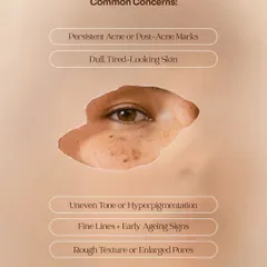 If you experience persistent acne, dull skin, uneven tone, fine lines, or enlarged pores, a chemical peel may be the right solution. This graphic lists the common concerns that indicate a need for professional skin resurfacing.