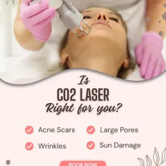 Is CO2 laser right for you? This graphic helps you decide. It's one of our most effective treatments for significant concerns like deep acne scars, wrinkles, large pores, and sun damage.