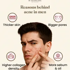 Men's skin has distinct biological characteristics that influence acne presentation. It is approximately 25% thicker, has larger pores, and produces more sebum, all of which can contribute to a higher likelihood of breakouts. Treatment must be adapted to these factors.