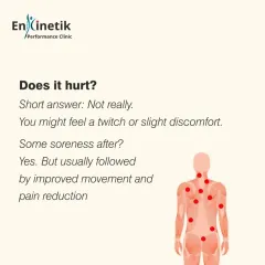 Does dry needling hurt? Not really. You might feel a brief muscle twitch or slight discomfort as the trigger point releases. Some soreness afterward is normal, but it is usually followed by improved movement and significant pain reduction.