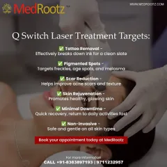 This graphic explains what the Q-Switch laser targets. It's a versatile tool I use for everything from tattoo removal and pigmented spots like freckles to reducing the appearance of acne scars.