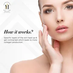An insight into how HIFU works: specific layers of the skin heat up and contract, which leads to more collagen production.