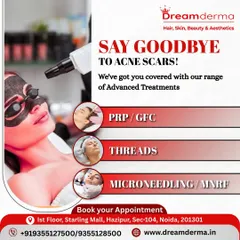 Say goodbye to acne scars with my range of advanced treatments. This graphic highlights PRP/GFC, Threads, and Microneedling (MNRF) as key solutions.