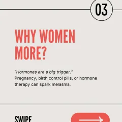 Hormones are a major trigger for melasma, which is why it is far more common in women. Pregnancy, birth control pills, and hormone therapy are frequent culprits for sparking these pigmentary changes.