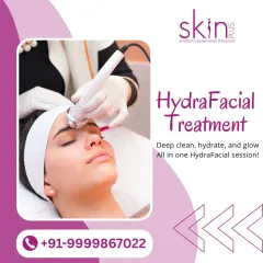 The HydraFacial is one of my most requested treatments for a reason. This image shows the multi-step process I use to deep clean pores, gently exfoliate, and intensely hydrate the skin, all with no downtime.