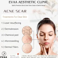 This visual guide explains different treatments for acne scars, including laser resurfacing, dermabrasion, and microneedling, showing how each method targets different levels of skin texture.