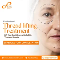 An illustration of where a professional thread lifting treatment can be applied. This procedure helps lift your confidence by providing subtle, timeless results for a refreshed appearance.