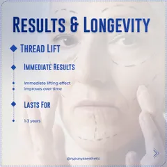 One of the biggest advantages of a thread lift is the immediate lifting effect, which continues to improve over time as collagen is produced. The results can last for 1 to 3 years.