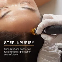 Step 1 of the Keravive treatment is to Purify. I use a special handpiece with light suction and exfoliation to stimulate and open up hair follicles, removing dirt and oil buildup.