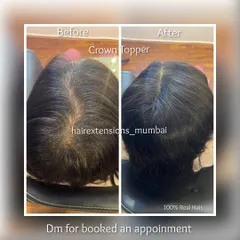 See the immediate difference a crown topper makes. This image contrasts the visible scalp before with the full, natural-looking coverage after application of the 100% real hair piece.