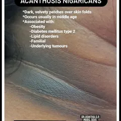 This graphic explains Acanthosis Nigricans, a condition characterized by dark, velvety patches in skin folds. It's often associated with obesity, diabetes, and other underlying issues, so a proper diagnosis is important.
