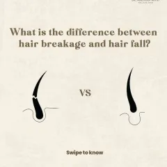 Understanding the difference between hair fall from the root and hair breakage along the shaft is the first step in a correct diagnosis. This distinction is critical as it dictates the entire course of treatment, ensuring we address the true underlying cause of your hair concern.