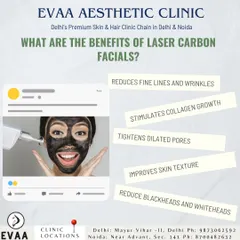 This infographic details the key benefits of Laser Carbon Facials, such as reducing fine lines, stimulating collagen, tightening pores, and improving skin texture.