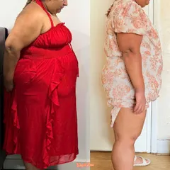 Anjali's side profile transformation. Her story is proof that a health diagnosis can be a powerful catalyst for change, and you don't have to do it alone.