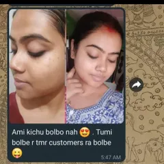 This is why I do what I do. Seeing my customers share their 'without filter' glowing skin pictures makes me so happy. This is the real result of using natural, handmade products consistently.