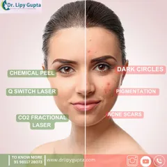 Different skin concerns require different solutions. This guide shows which of my advanced treatments, like Q-Switch laser and chemical peels, are best suited for tackling issues like pigmentation, dark circles, and acne scars.