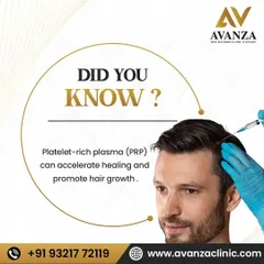 Did you know that Platelet-Rich Plasma (PRP) can accelerate healing and promote hair growth? This informative graphic shows a doctor administering the treatment, which is a key part of our hair restoration process.