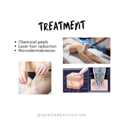 For persistent keratosis pilaris, I may recommend in-office treatments. Procedures like chemical peels, laser hair reduction, and microdermabrasion can help smooth the bumps and reduce associated redness.
