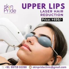 Get a permanent solution for unwanted upper lip hair for only ₹499. Our laser treatment is fast, safe, and effective, giving you smooth skin in just a few minutes.