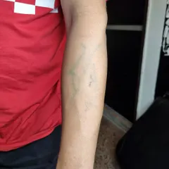 This is the 'before' photo, showing the faint, greenish old tattoo on the forearm that was completely covered by the new dragon design.