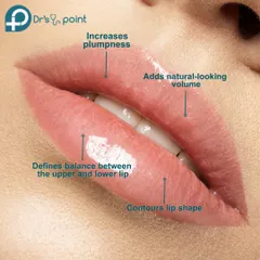 This graphic highlights the key benefits of our lip filler treatments. We focus on increasing plumpness, adding natural volume, contouring the lip shape, and defining the balance between lips.