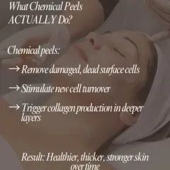 This graphic explains what chemical peels actually do. They work by removing damaged surface cells, stimulating new cell turnover, and triggering collagen production, resulting in healthier, stronger skin over time.