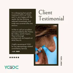 A client testimonial praising the immediate reduction in hair thinning after GFC treatment. He highlights the excellent care and professionalism of my team.