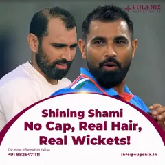 No cap needed. Mohammed Shami's real hair and real wickets are a testament to his skill and renewed confidence. We are happy to have been part of his journey.