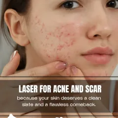 Your skin deserves a clean slate. Our advanced laser treatments for acne and scars target blemishes deep within the skin, smoothing uneven texture and restoring your skin's natural clarity for a flawless comeback.