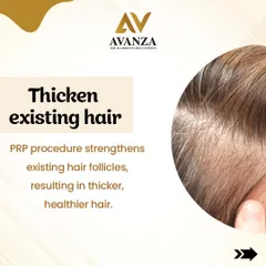 PRP strengthens existing hair follicles, which results in thicker, healthier hair. This procedure helps improve the overall density and texture of your hair without any surgical intervention.