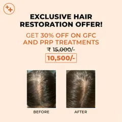 A widening hair part is a common sign of hair thinning. This before and after photo demonstrates how our targeted GFC and PRP treatments can effectively increase hair density and improve scalp coverage.