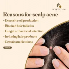 The reasons for scalp acne are varied. They include excessive oil production, blocked hair follicles, fungal or bacterial infections, irritation from hair products, and in some cases, reactions to certain medications.