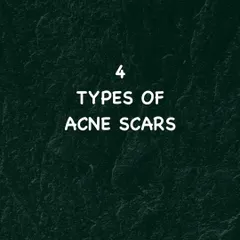 A closer look at the four primary categories of acne scars. Identifying whether you have ice pick, boxcar, rolling, or hypertrophic scars is crucial for effective treatment.